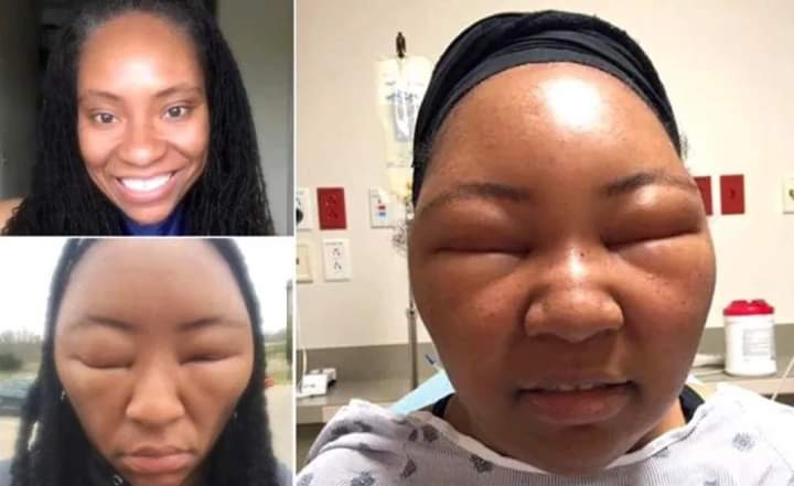 “I’m So Happy My Wife Cheated With A Married Man And His Wife Beat Her Up” – Husband Exposes Cheating Wife