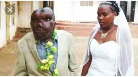 Remember The Lady Who Married The Ugliest Man In Uganda? See Her Condition After 7 Years With Him