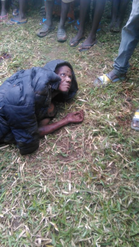 Suspected thief who had his legs chopped dies in Nsanje