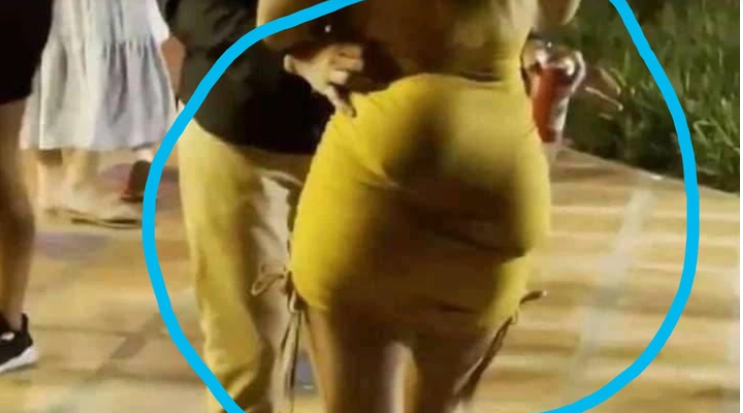 Lady turns into an embarrassment after her artificial bums did this in front of people (Photos)