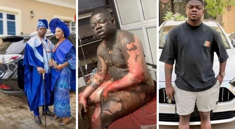 Police launch manhunt against woman for roasting her husband over cheating