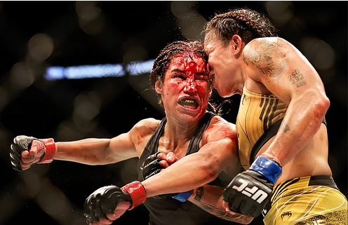 Female fighter rushed to hospital and taken to see a plastic surgeon after losing a ‘big chunk’ of her forehead during brutal fight (photos)
