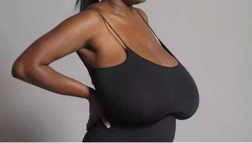 5 reasons breasts sag  (Mabere Kugwa)