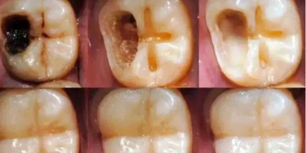 If You Have Tooth Pains, Don’t Go To Dentist, Use This Tricks Instead