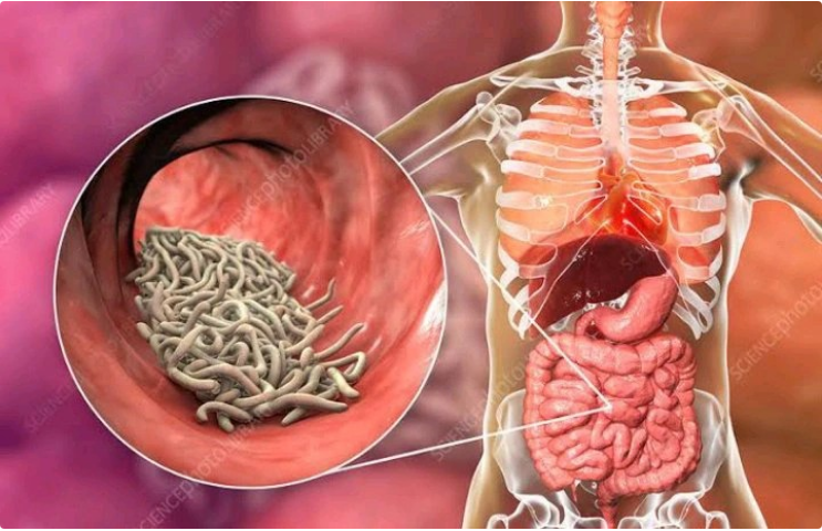 2 Body Parts You May Feel Pain When You Have Excess Worms In Your Body