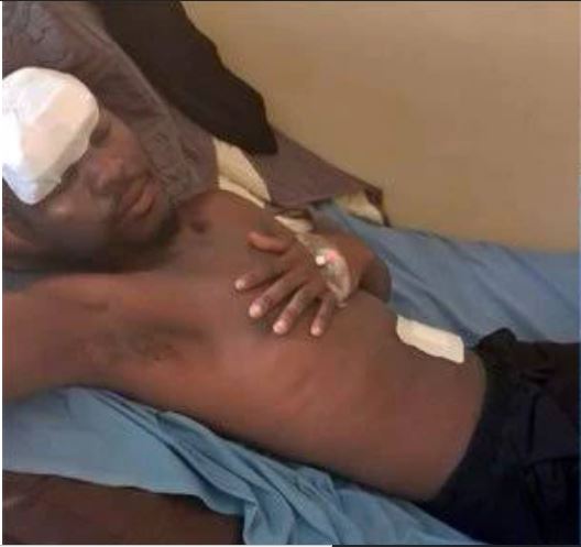 Confusion As Ugandan Man Who Went For A Head Surgery Finds His Left Kidney Missing After The Operation