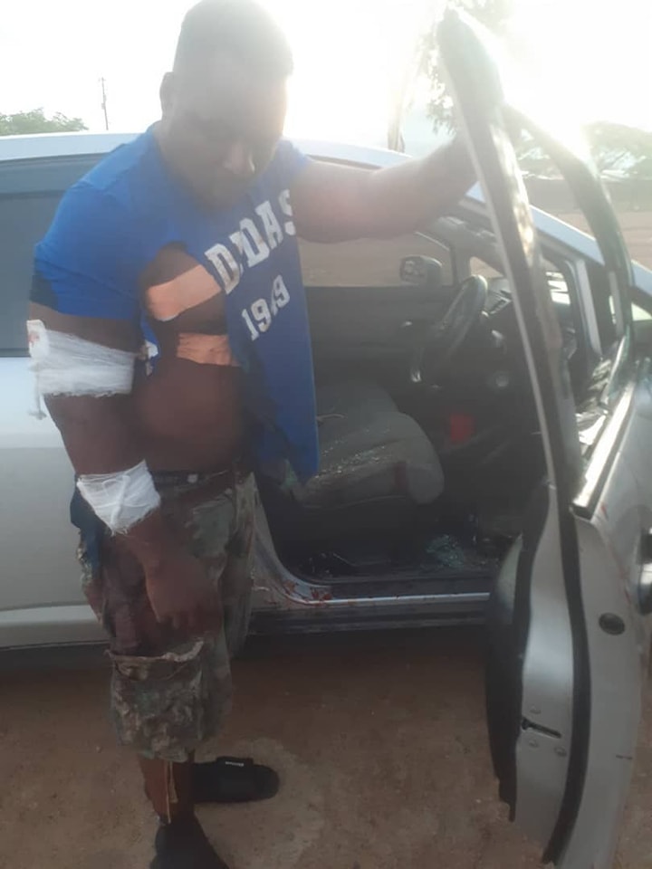 Musician IKK attacked by armed thieves in Chirimba