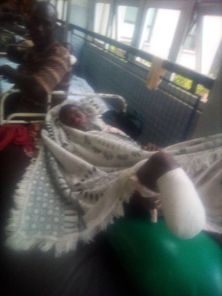 17 year old boy loses leg after being shot by a forest guard in Dedza