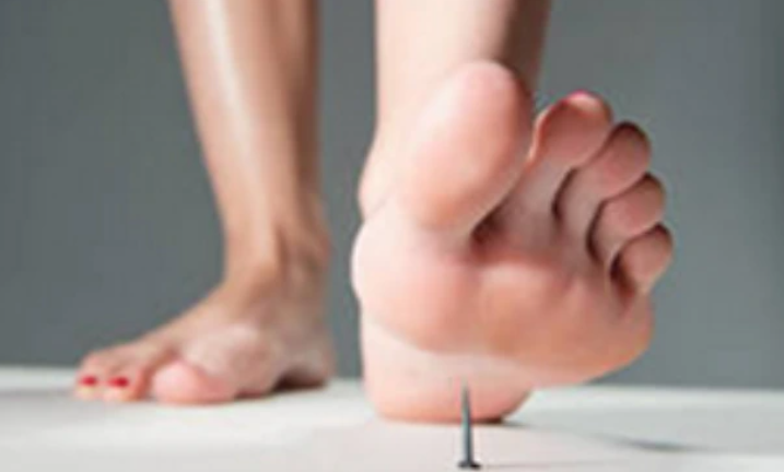 If You Mistakenly Step On A Rusted Iron Nail, Please Do These 2 Things Immediately