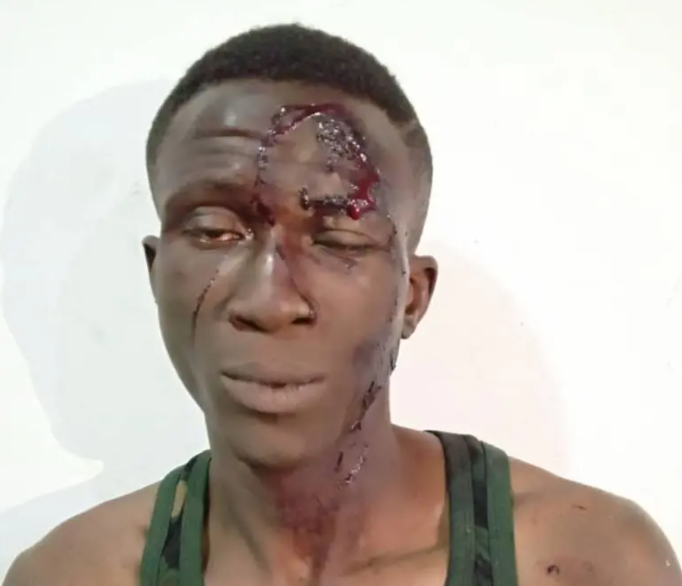 Notorious Abuja Armed Robber Nabbed for Stabbing Victim Over iPhone in Nigeria