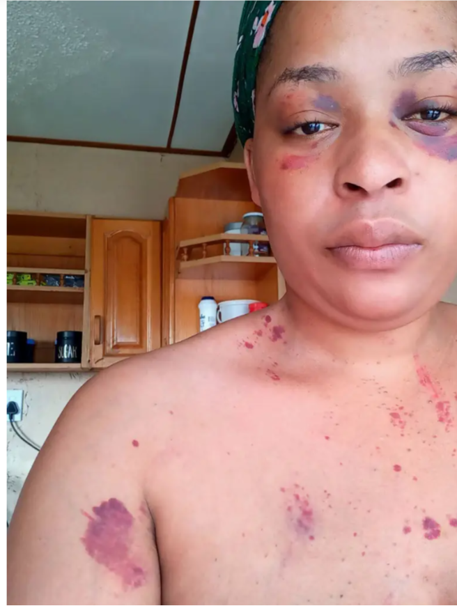 South African woman brutally beaten by her police officer boyfriend