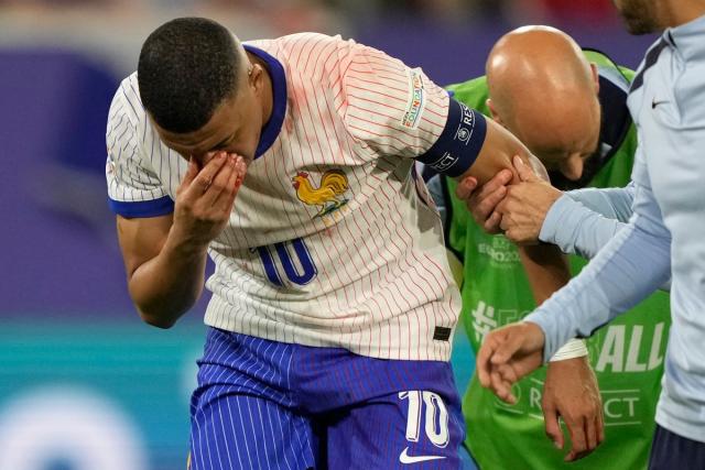 Mbappé Returns To The Camp With A Mask After Nose Injury