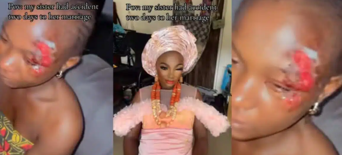 Sad as Bride-to-be involved in accident 2 days before wedding (Watch Video)