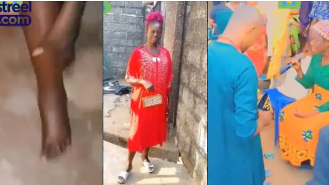 This Is Sad! Mother’s leg swollen after being warned not to attend daughter’s wedding (Watch Video)