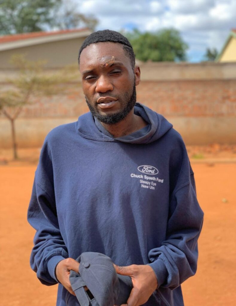 Police Confirm Night Attacks in Area 25, Several Victims Reported