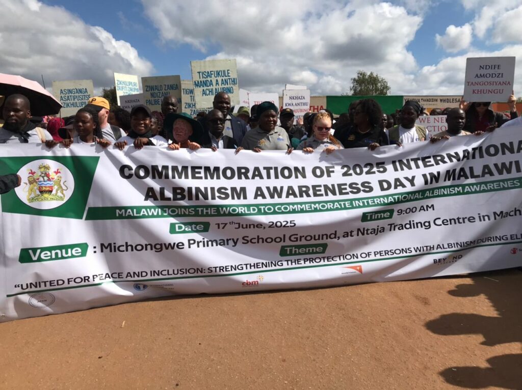 Malawi Hosts Albinism Awareness Day In Machinga