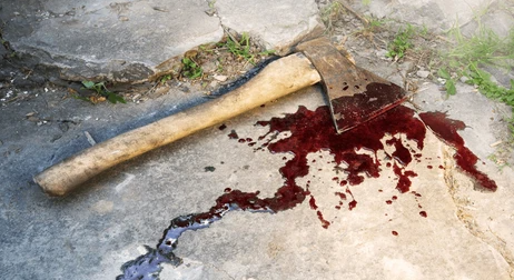 Young Man Axed by Cousin in Zambia