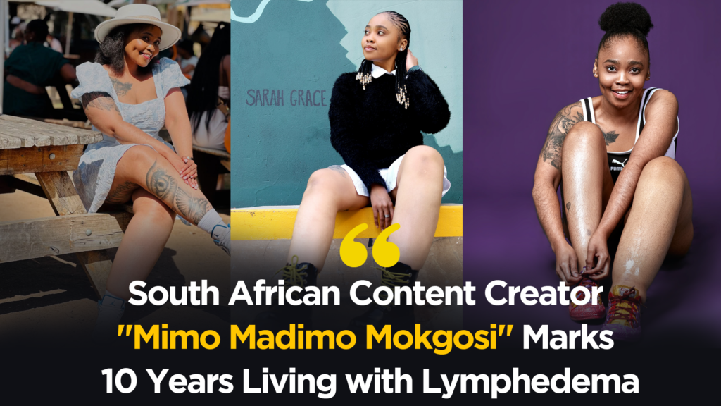 South African Content Creator “Mimo Madimo Mokgosi” Marks 10 Years Living with Lymphedema