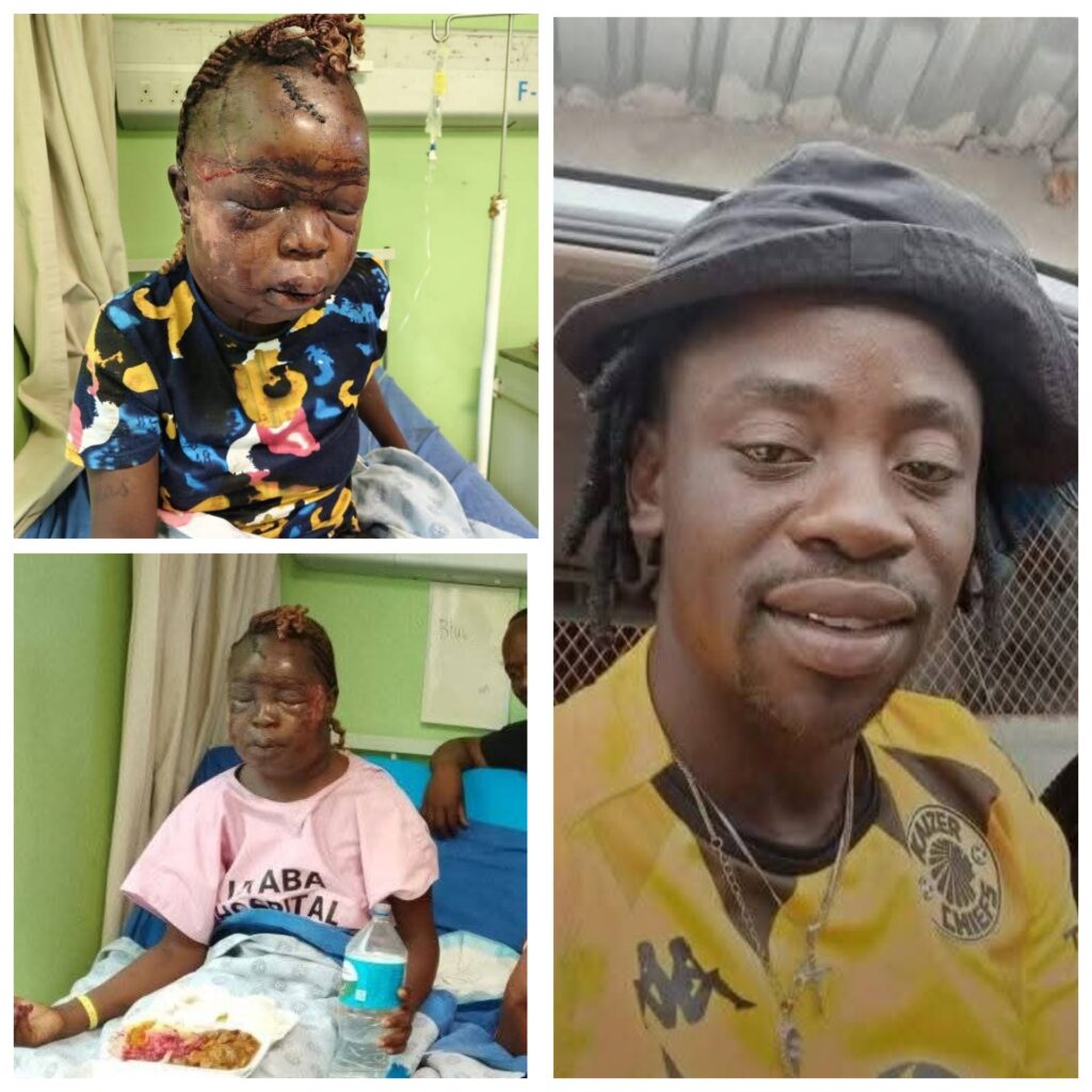 SAD|| South African woman beaten to pulp by her ex-boyfriend