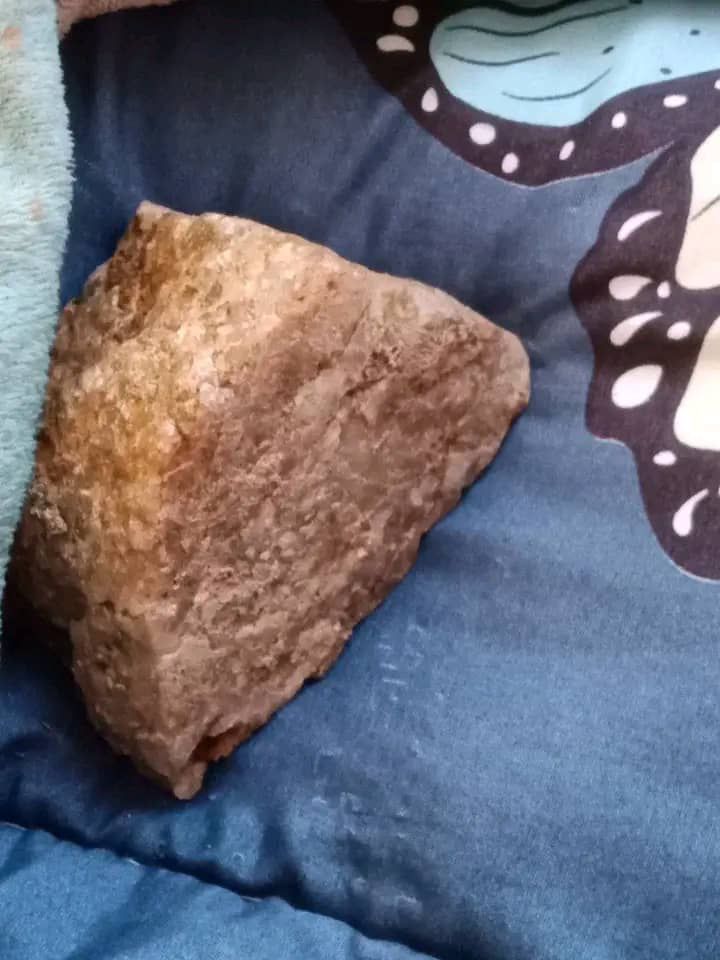 Woman Gives Birth to a 250g Stone in Neno