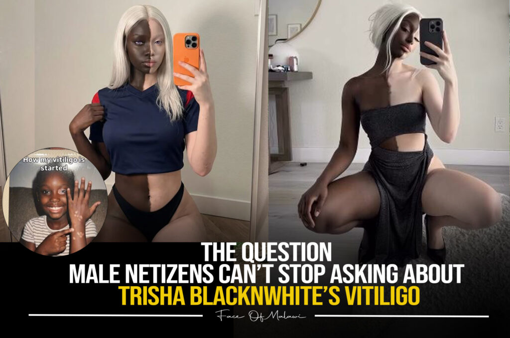 The Question Male Netzens Can’t Stop Asking About ‘Trisha BlacknWhite’s Vitiligo