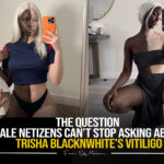 The Question Male Netzens Can’t Stop Asking About ‘Trisha BlacknWhite’s Vitiligo