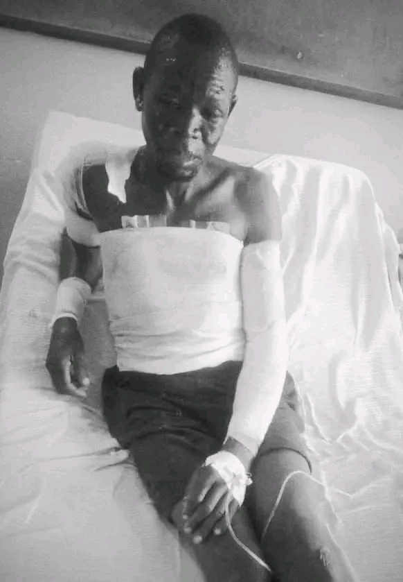 Monkey Bay Woman on the Run After Allegedly Pouring Boiling Water on Husband