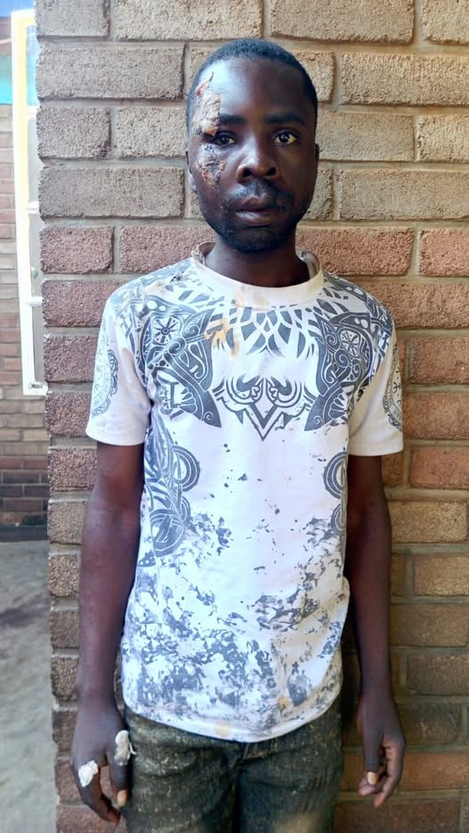 Police Recover Stolen Motorcycle, Cash, and Phone Following Suspects’ Road Accident