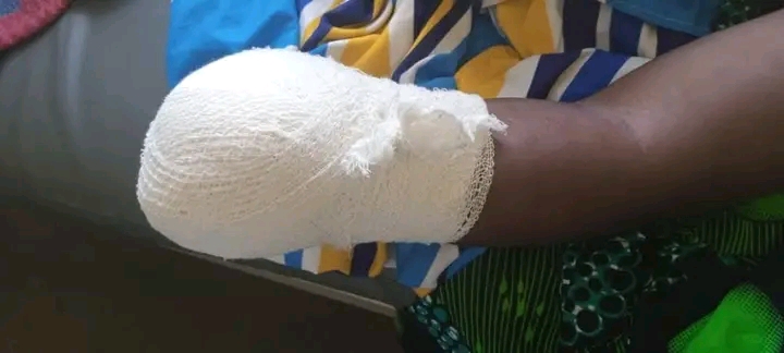 Police in Karonga launch manhunt for suspect accused cutting off business partner’s hand