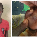 Mother Arrested in Mwanza for Burning Child Over Alleged Theft