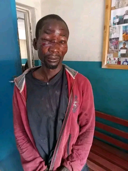 Stolen ESCOM Conductors Turned Into Cooking Pots, Three Nabbed