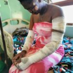 Woman Hospitalised After Gas Cylinder Explosion in Mangochi