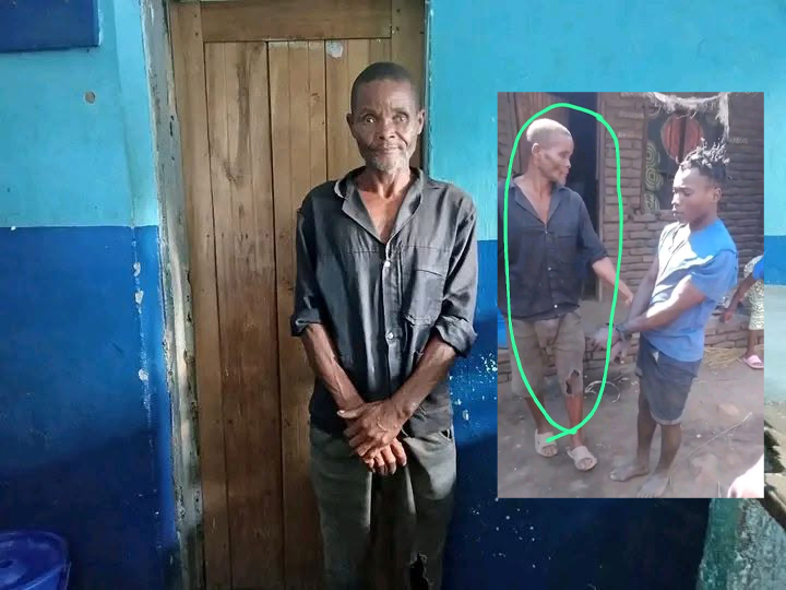 66 Year-old Man Jailed 5 Years For Chopping Off Alleged Sweet Potato Thief’s Fingers in Mangochi