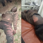 Suspected ESCOM Transformer Thief Electrocuted During Foiled Theft Attempt in Lilongwe